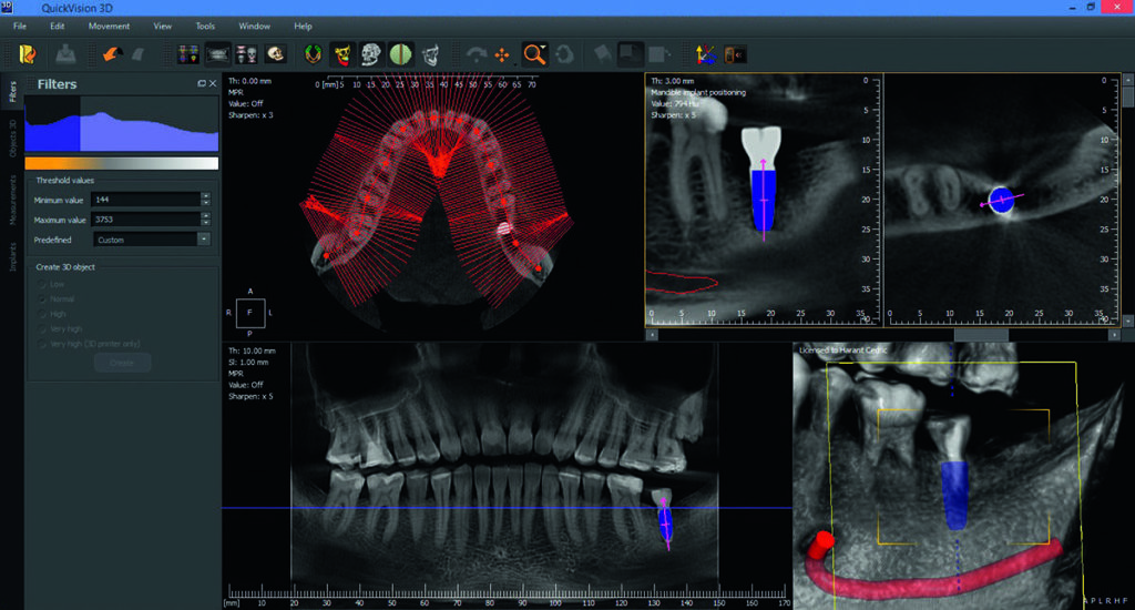 QuickVision3D-v2c-2-1-1024x550-1